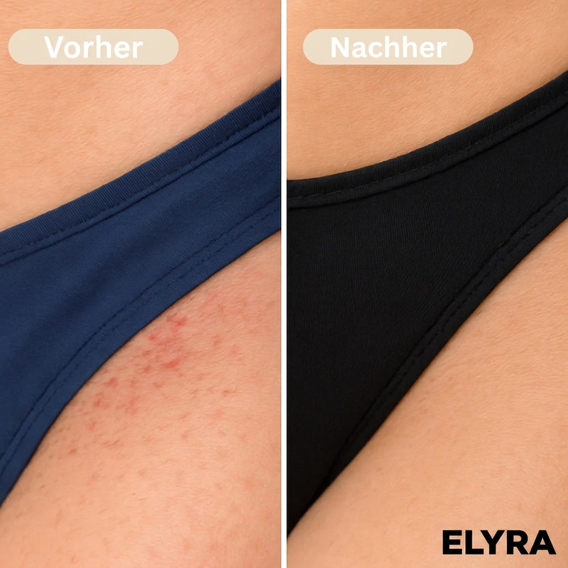 Elyra Silk Shaver — 2-in-1 Elektrorasierer für seidig glatte Haut ohne Pickelchen